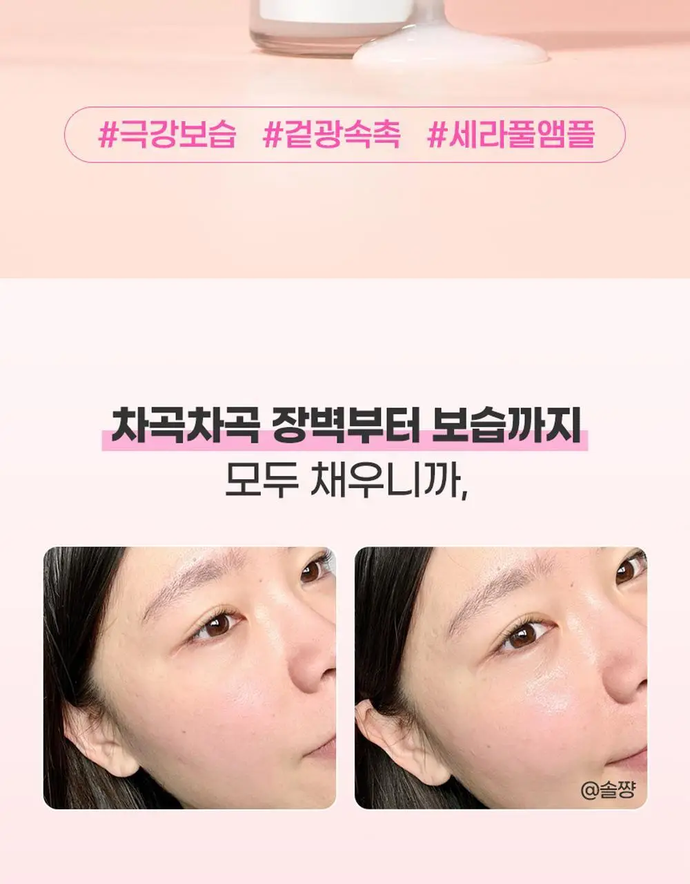 [재구매1위] 앰플엔 세라마이드샷 화잘먹 보습장벽앰플 100ml기획(+10ml) 상세페이지 6